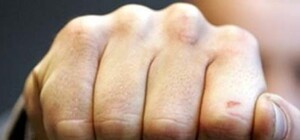 Скандал в одесском суде: опубликовано видео конфликта, в котором сломали нос активисту