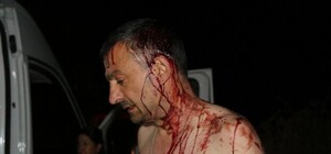 С железными битами: под Одессой спортсмены избили главреда местной газеты