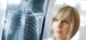 Проверь себя: в Днепре будут работать передвижные флюорографы