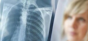 Где в сентябре в Киеве можно бесплатно пройти флюорографию. Адреса