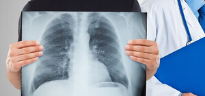 Где в декабре в Киеве можно бесплатно пройти флюорографию. Адреса