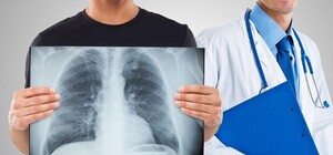 Планы на март: где в Киеве можно бесплатно пройти флюорографию. Адреса