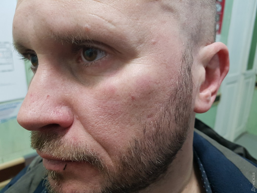 Ночью напали на одесского телеведущего, журналиста «Думской ТВ» Александра Новицкого. Фото: Думская