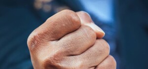 Смешно и грустно: на Трассе здоровья произошла странная драка