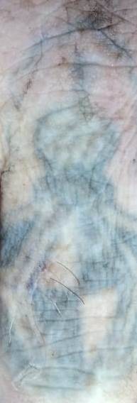 Фото Нацполиции