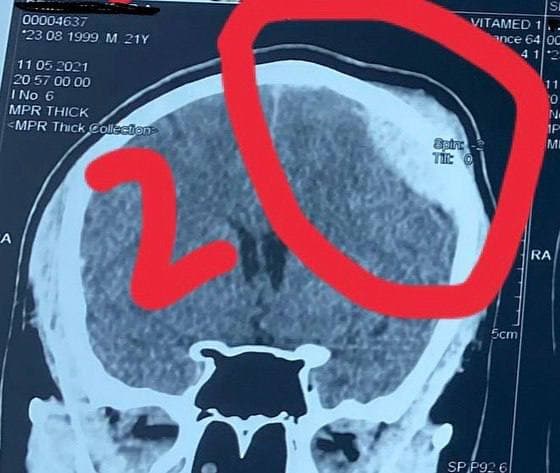 ЧП на Трассе Здоровья. Фото: "Подслушано"