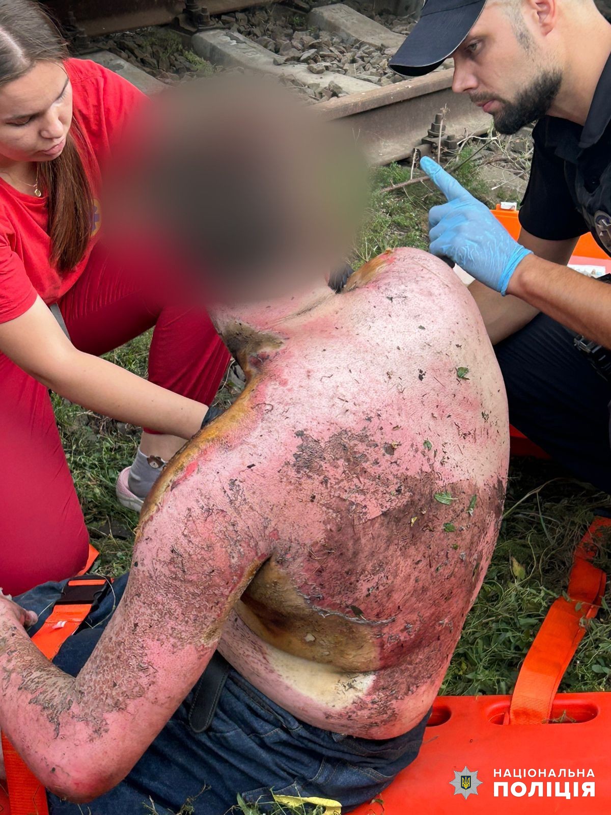 Под Одессой двое подростков забрались на крышу вагона ради фото и получили серьезные ожоги.