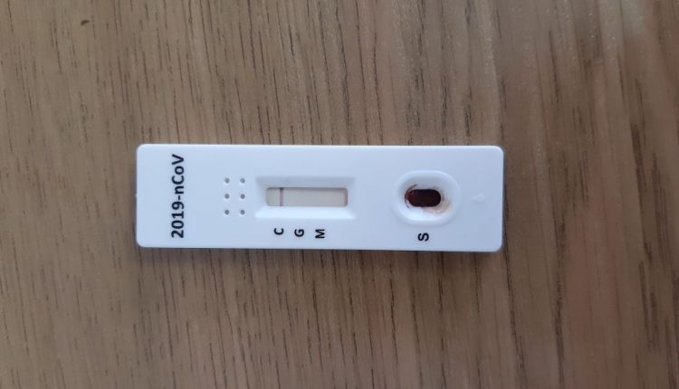 Украинский тест на коронавирус. Фото: usionline.com