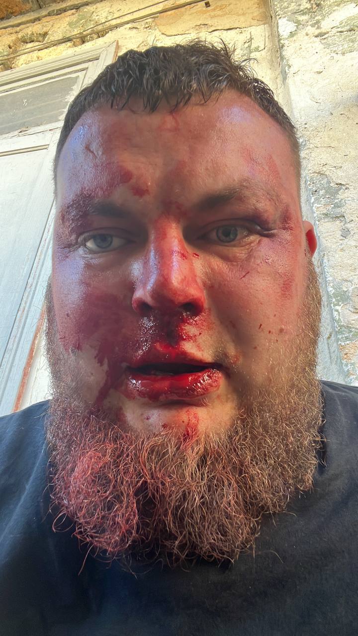 Одесский активист Демьян Ганул заявил, что на него напали.