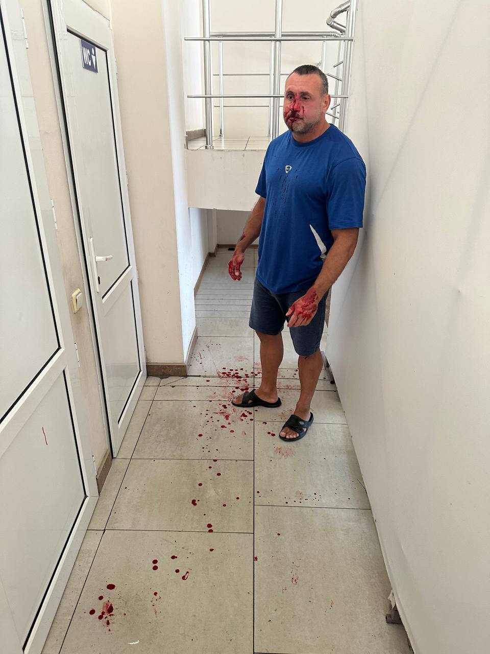 В Одессе фитнес-тренер "послал" военного: его нашли и разбили ему лицо.