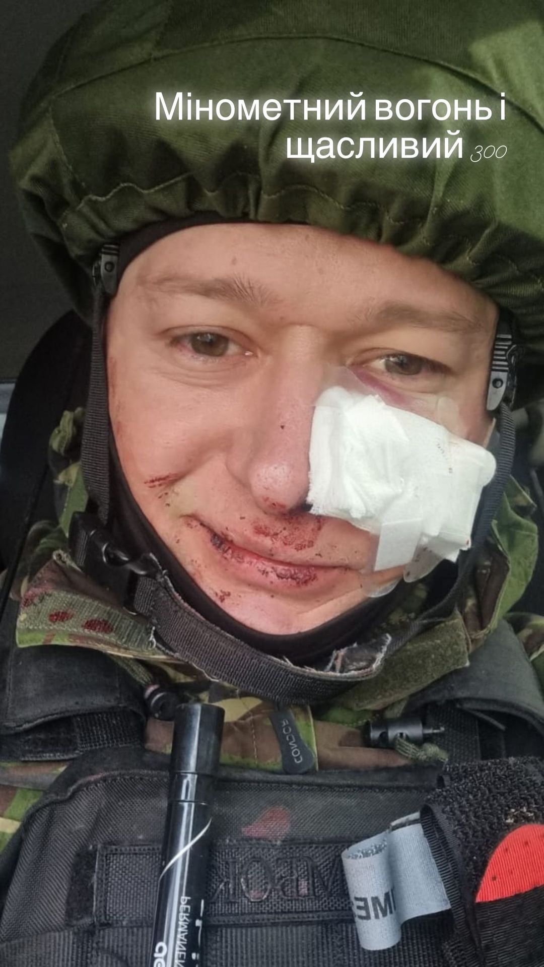 Андрей Хлывнюк попал под минометный обстрел - фото: instagram.com/andriihorolski/