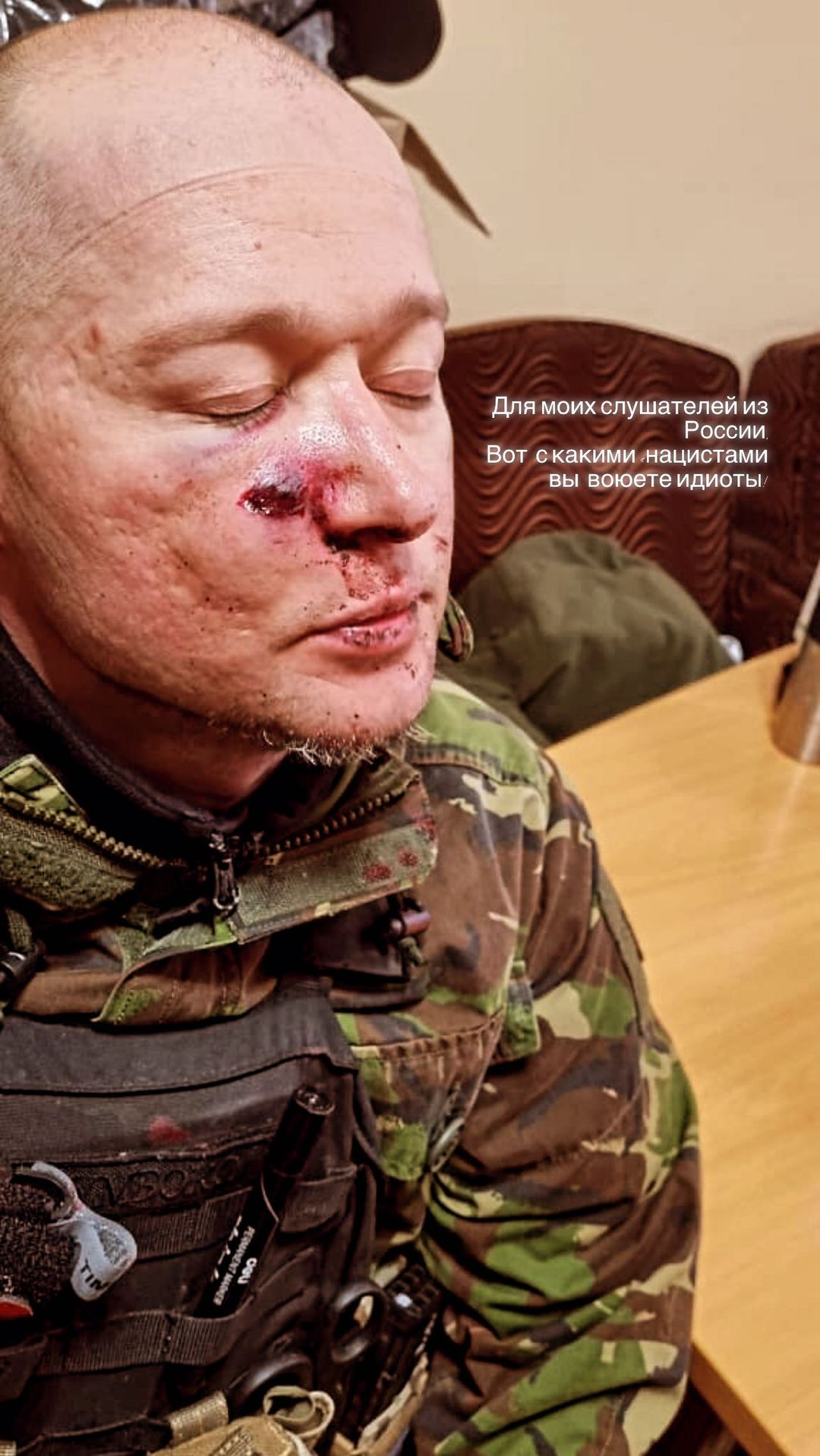 Андрей Хлывнюк попал под минометный обстрел - фото: instagram.com/andriihorolski/