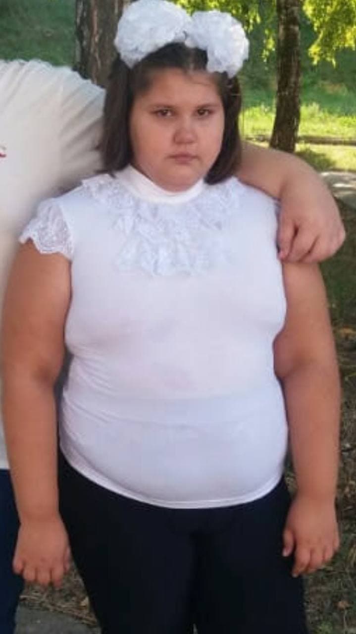 В Черноморске умерла умерла 11-летняя Катя Стасюк