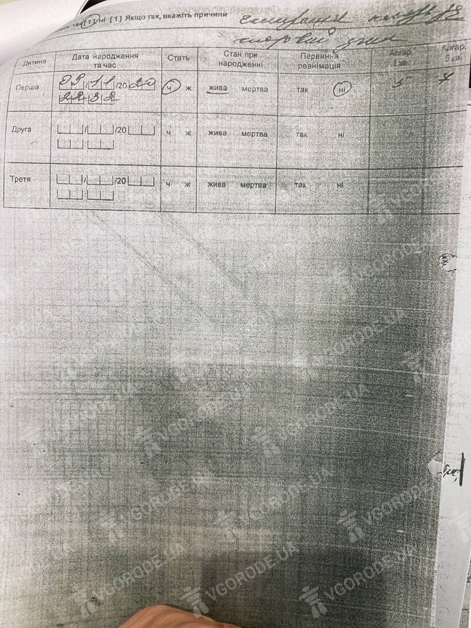Медицинский документ Юлии Коломиец, где указано, что реанимация ребенка не проводилась