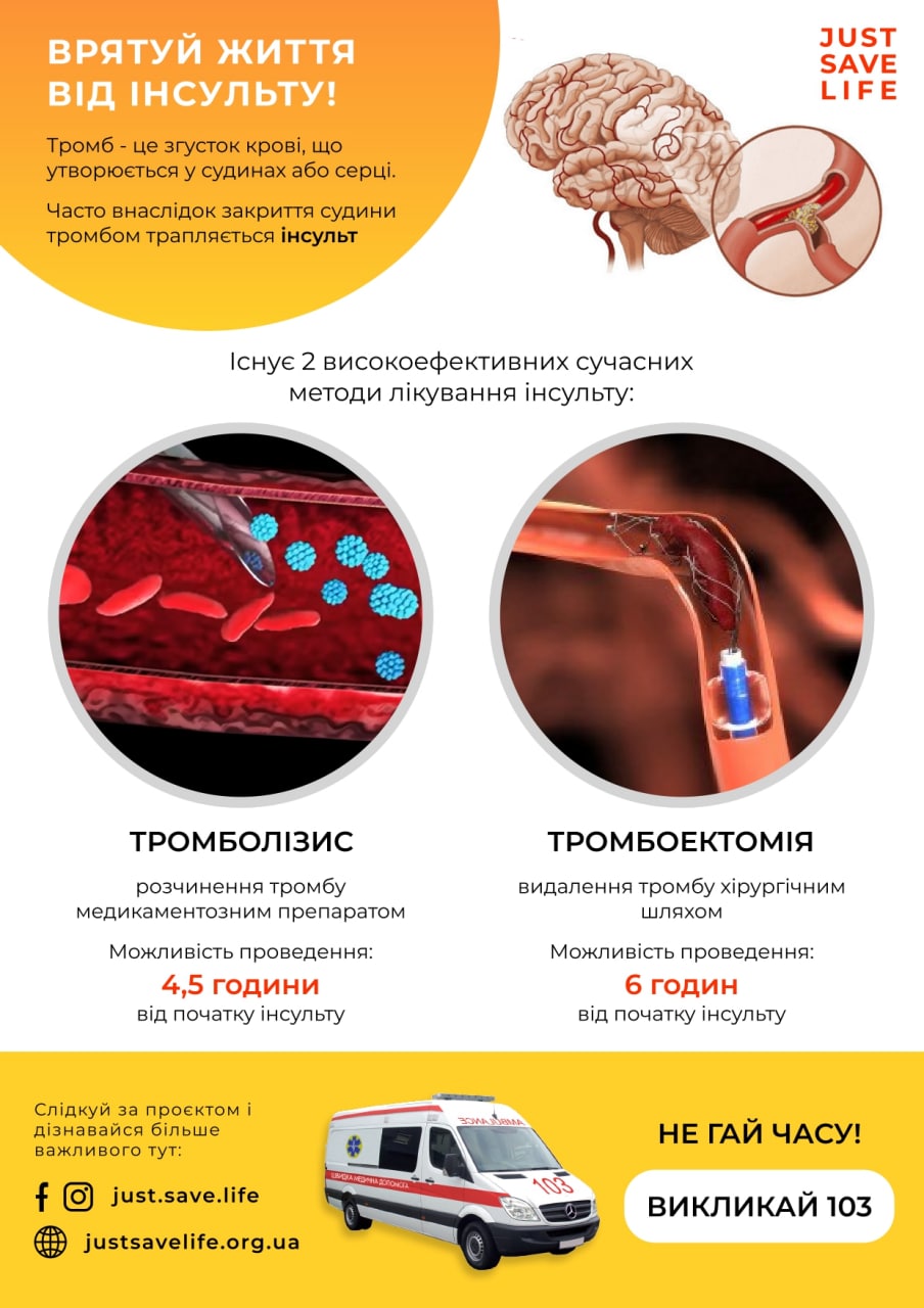 Инфографика о признаках инсульта, созданная командой.