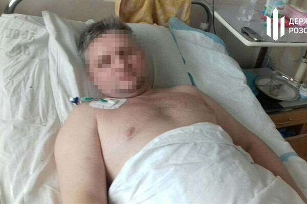 Требовали признать вину: в Одесской области полицейские избивали и пытали автомобилиста фото
