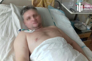 Требовали признать вину: в Одесской области полицейские избивали и пытали автомобилиста фото