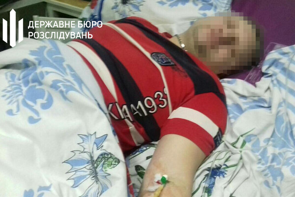 Требовали признать вину: в Одесской области полицейские избивали и пытали автомобилиста фото 2