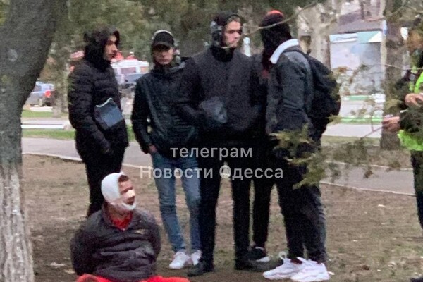 Пять ножевых: под Одессой мужчина напал на продавца овощной лавки фото 4