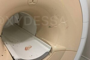 В Одессе пациента на инвалидном кресле засосало в МРТ-сканер: пострадали двое человек фото