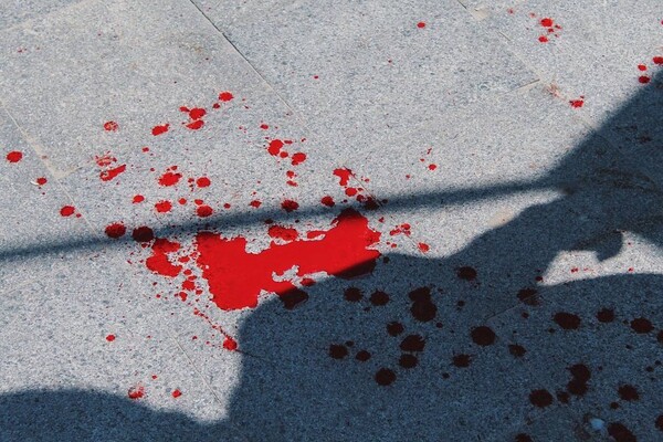 В Одессе избили общественников: они собирали подписи против &quot;Одесса Прайд&quot; фото 4