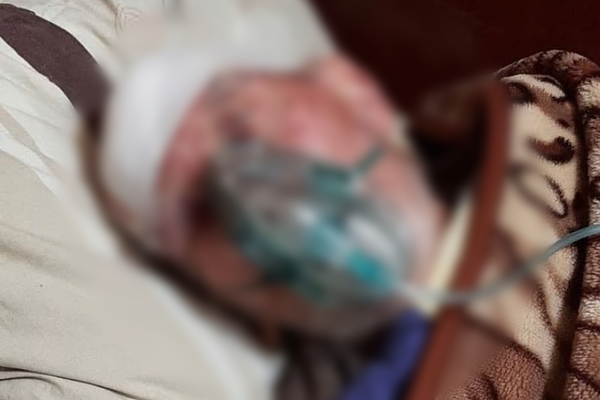 Мигрант с разбитой головой попал в реанимацию после падения на стройке на Заневском