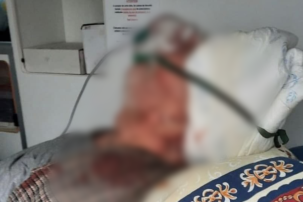 Отправили умирать с разбитой головой: в одесской больнице залечили пенсионера с Covid-19 фото 2