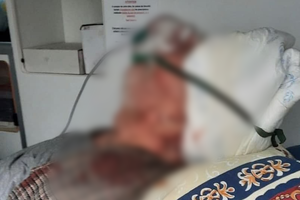Отправили умирать с разбитой головой: в одесской больнице залечили пенсионера с Covid-19 фото 2