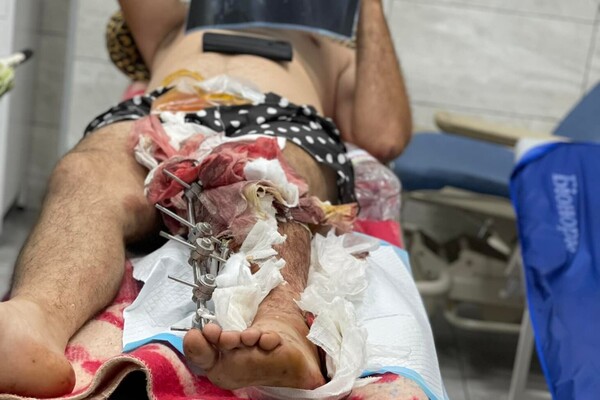 Одеські волонтери закликають допомогти пораненим військовим фото 2