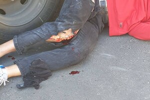 За добу в Одесі сталося дві ДТП: постраждали велосипедист та мотоцикліст фото 2
