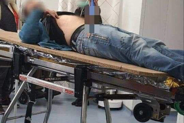 На Одещині чоловік ударив себе ножем у живіт через розтавання з дівчиною фото 1