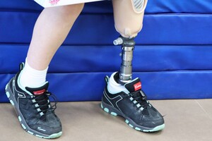 Незламна: як зараз живе маленька Олександра Паскаль, яка втратила ніжку після обстрілу в Затоці фото 1