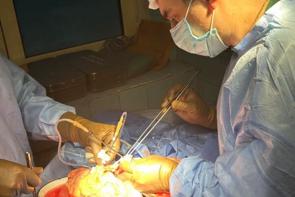 В Одесі вперше провели трансплантацію серця фото 6