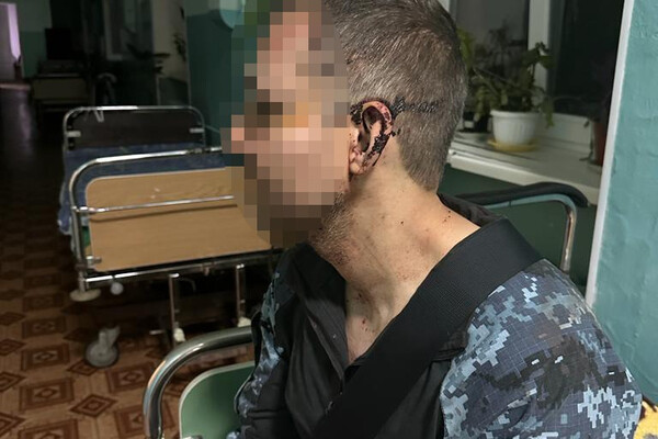 ДБР взялась за расследование избиение солдата в одной из воинских частей в Одесской области фото 1