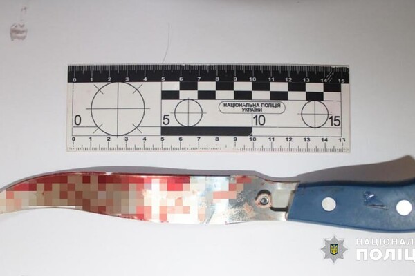 На Фонтанській дорозі жінка ножем порізала двох колег фото
