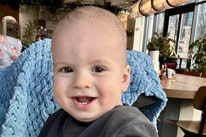 Малышу из Одесской области сделали уникальную операцию на язык: он был в пять раз длиннее фото 2