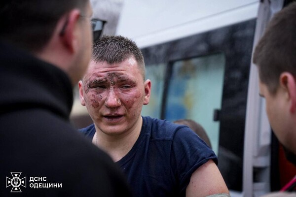 Из-за атаки РФ сегодня в Одессе пострадали 20 человек и десять домов фото 4