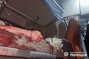 Враг атаковал Одесский район баллистикой: есть раненые и погибшие, среди жертв &ndash; десятилетняя девочка (обновлено) фото 9