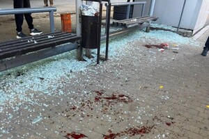 Ранковий удар по зупинці в Одесі: зазнали осколкових поранень люди фото 4