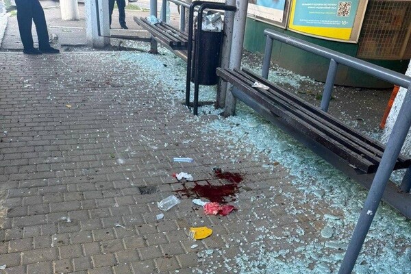 Ранковий удар по зупинці в Одесі: зазнали осколкових поранень люди фото 9