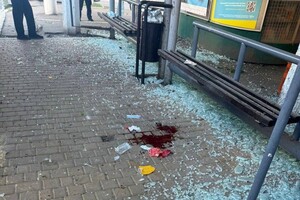 Ранковий удар по зупинці в Одесі: зазнали осколкових поранень люди фото 9