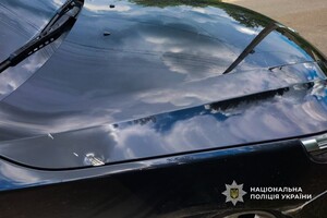 На Одещині водій навмисно наїхав на прикордонника: військовий постраждав фото 1