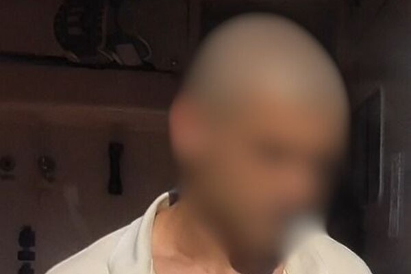 В Одесской области водитель намеренно наехал на пограничника: военный пострадал фото 3