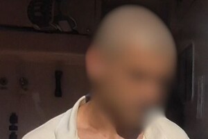 На Одещині водій навмисно наїхав на прикордонника: військовий постраждав фото 3