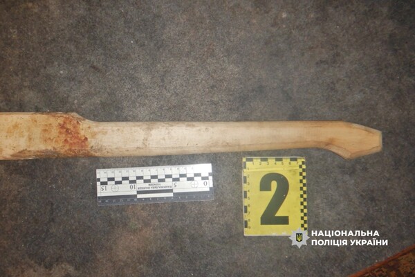 Била руками и топором: в Одесской области пьяная мать пытала пятилетнего сына фото 4
