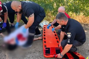 В Одесской области столкнулись два автобуса: есть жертвы, среди пострадавших – дети (обновлено) фото 14